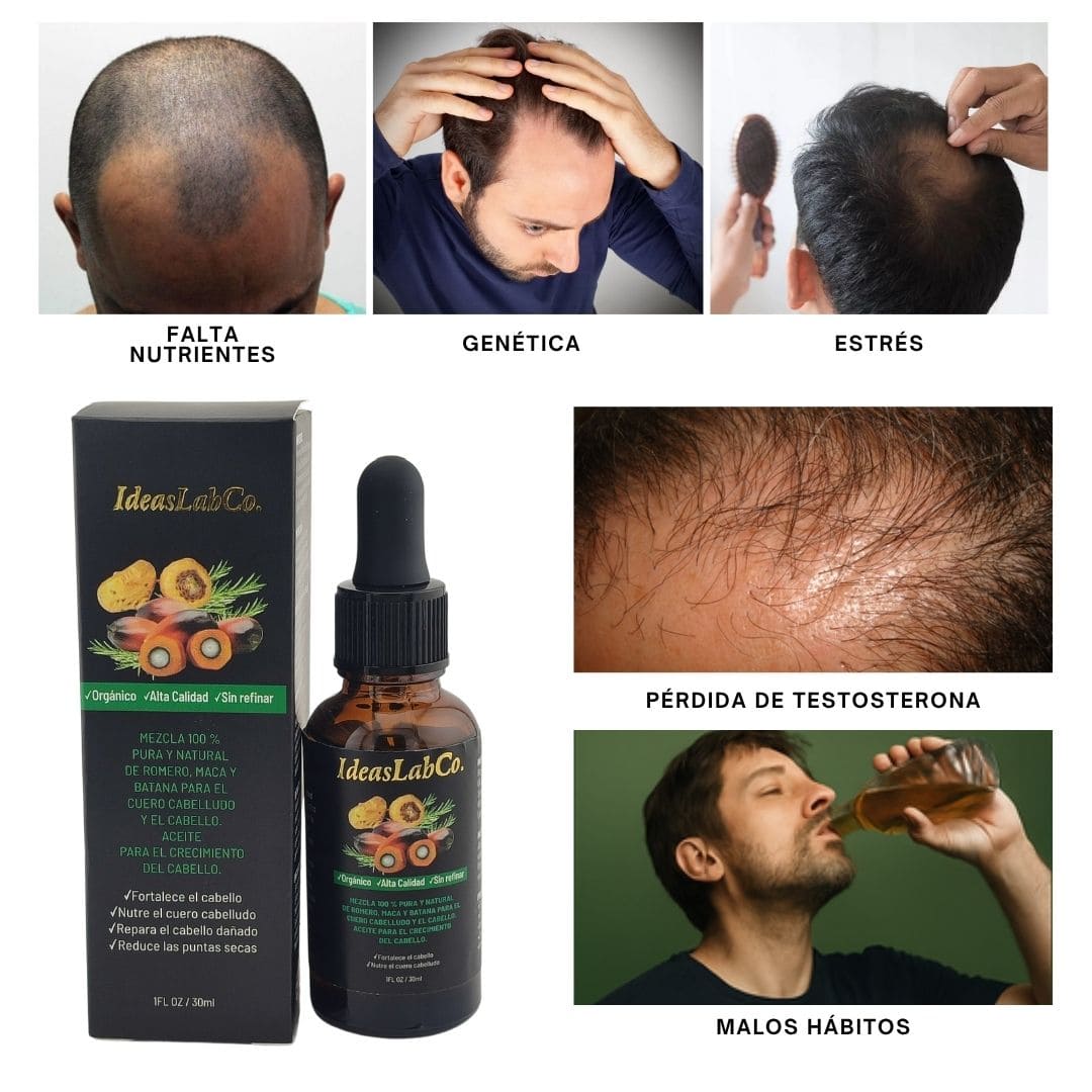 Aceite Capilar para hombres a base de Batana, Romero y Maca - Fortalece, Restaura y Estimula el crecimiento