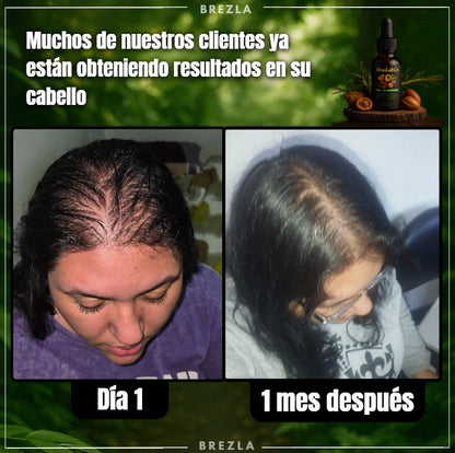 Aceite para crecimiento de cabello - Aceite de Batana con Romero y Maca Fórmula 100% orgánica y Nutritiva